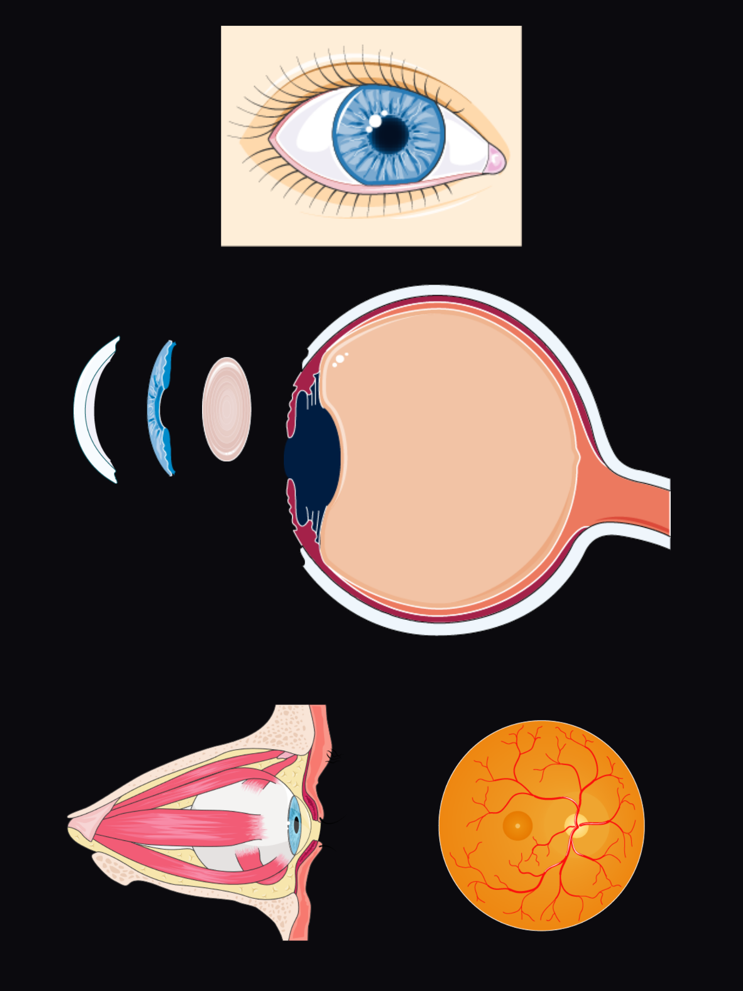 Exploded view of the eye: the eye from the front with its lids, the cornea, iris and lens floating in front of the eyeball in section, the orbit with the extraocular muscles, and the retina as seen through an ophthalmoscope.